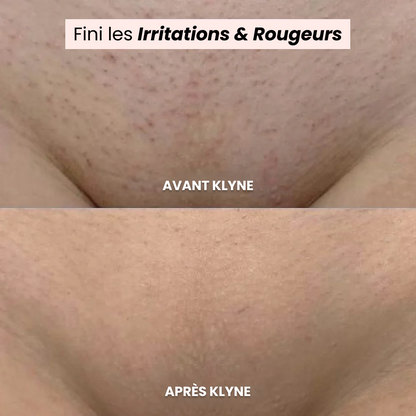 Cloom™ - Rasoir 2 en 1 pour femmes